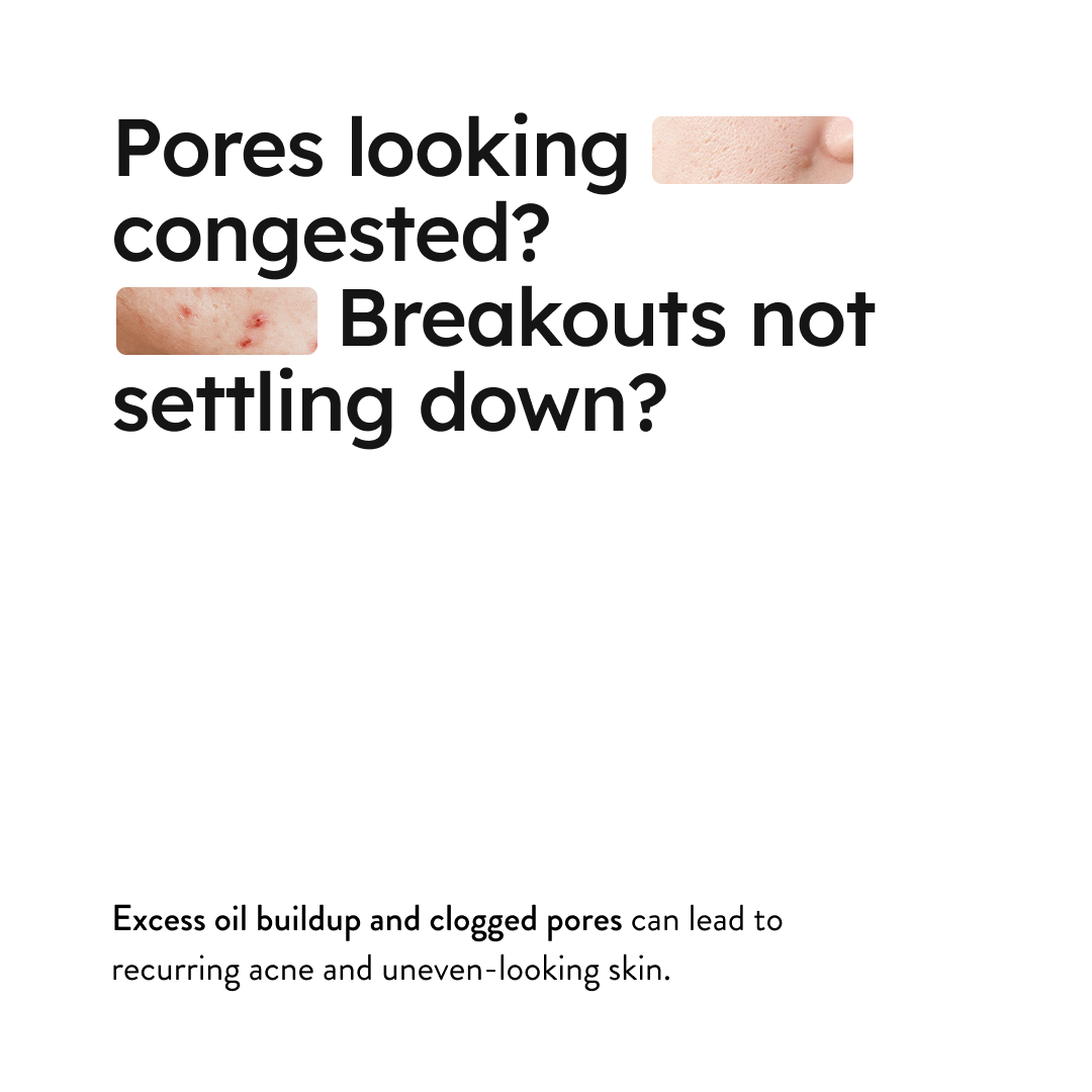 Pore Clarifying Serum 2% Salicylic Acid (30ml) Secondary image