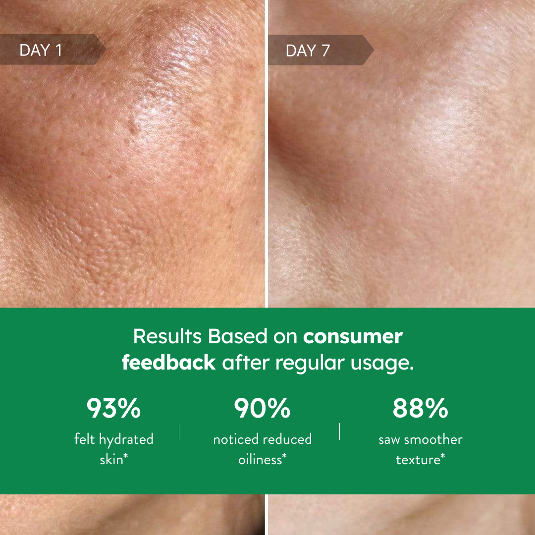 Niacin Glow Moisturizer
