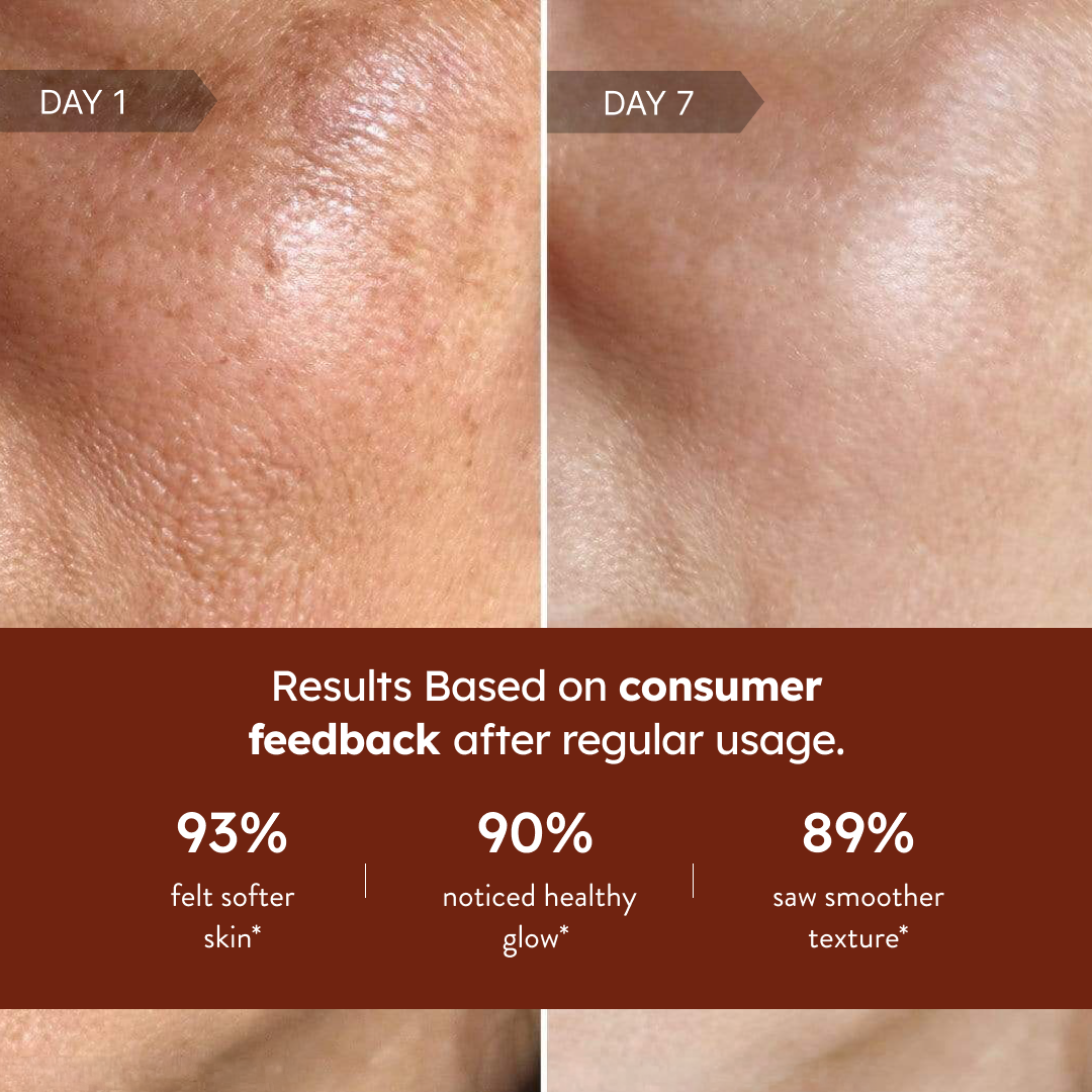Nourish & Glow Body Lotion (300ml) Secondary image