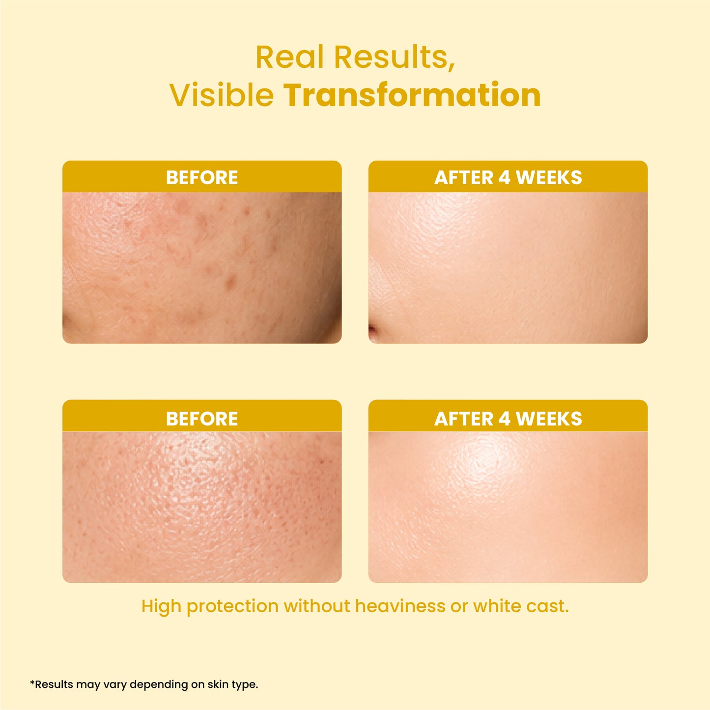 Anhydra UV Shield Sunscreen SPF 50+ PA+++