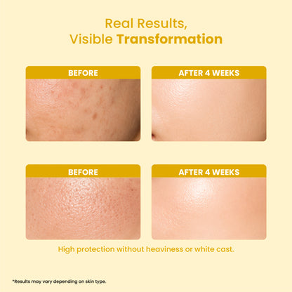 Anhydra UV Shield Sunscreen SPF 50+ PA+++