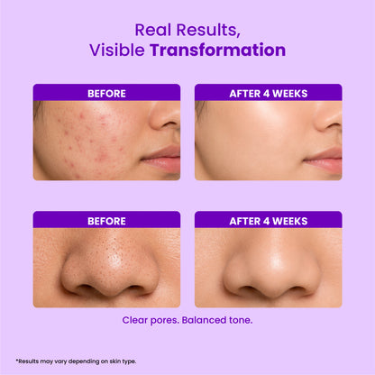 Pore Clarifying Serum 2% Salicylic Acid (30ml)