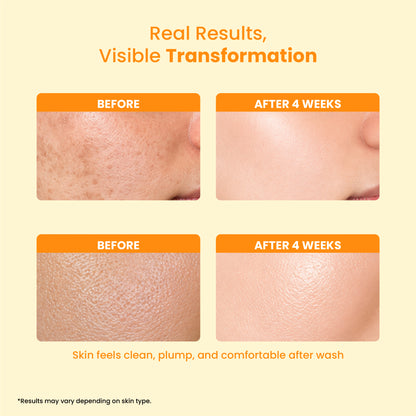 Radiance Vitamin C Cleanser (100ml)
