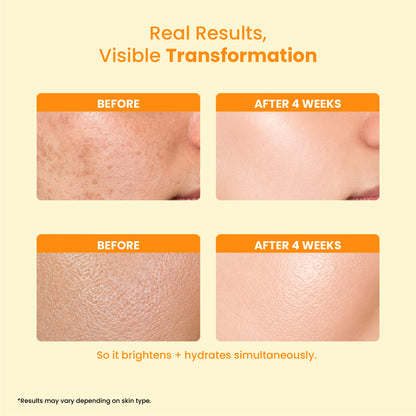 Radiance Serum 10% Vitamin C + 5% Niacinamide (30ml)