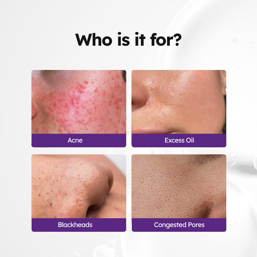 Pore Clarifying Serum 2% Salicylic Acid (30ml) Secondary image